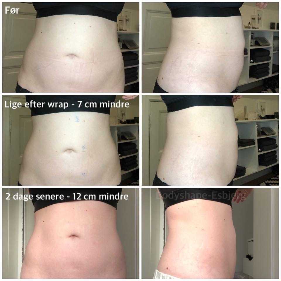 Body wrap - før-efter Effekt body wrap