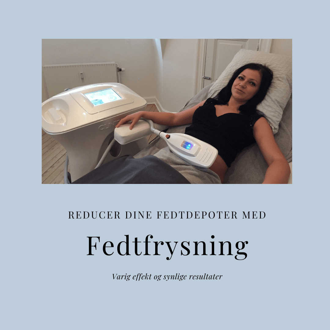 Fedtfrysning hos Bodyshape-Esbjerg